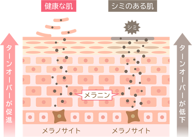 ターンオーバー