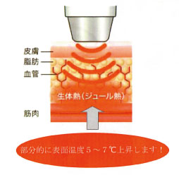 生体熱の説明 生体熱の説明