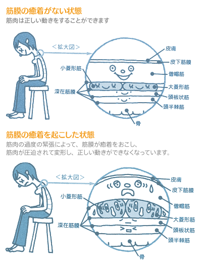 画像の説明