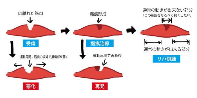 画像の説明