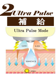 Ultra Pulse モード画像