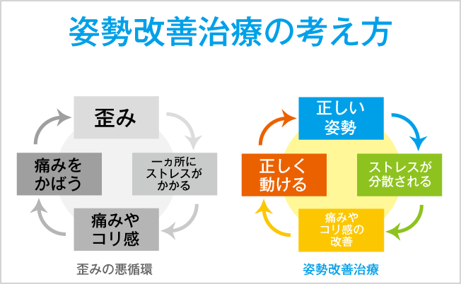 姿勢矯正の考え方