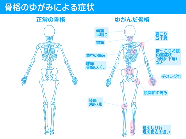 姿勢改善