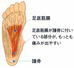 画像の説明