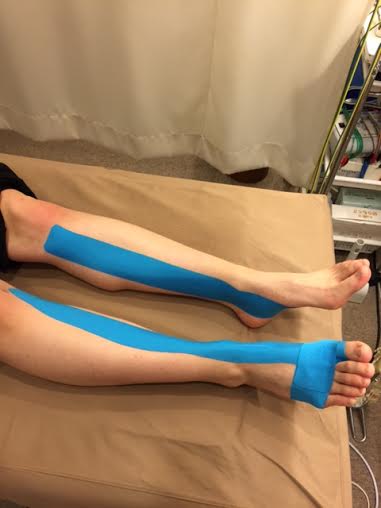 趾関節捻挫とシンスプリントのテーピング ブログ 豊中 少路で整体 産後骨盤矯正は美療鍼灸整骨院