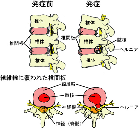 画像の説明