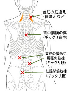 画像の説明