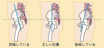 画像の説明