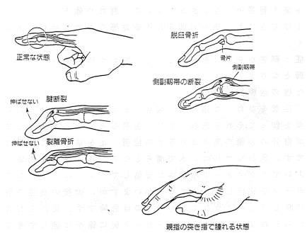 画像の説明